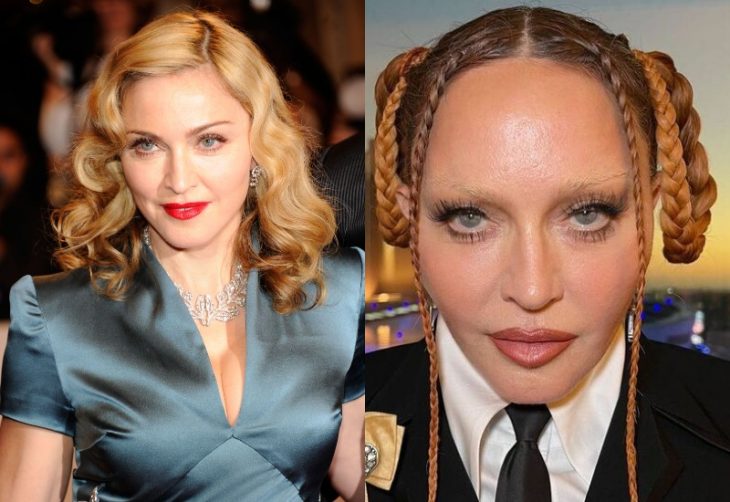Celebrities Who Ruined Their Beauty: Before-And-After Pics